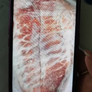 改包助排