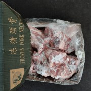 颈骨