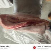 背膘