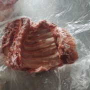 去颈前排