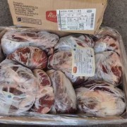 1399后腱