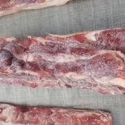 379腰椎骨