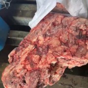 淤血肉