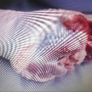 前后猪肘
