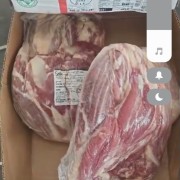 2543排腱